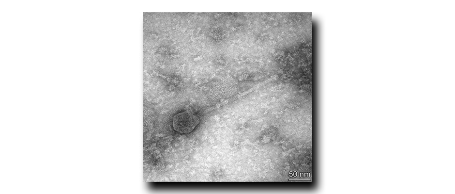 a black and white microscope image of the jant bacteria